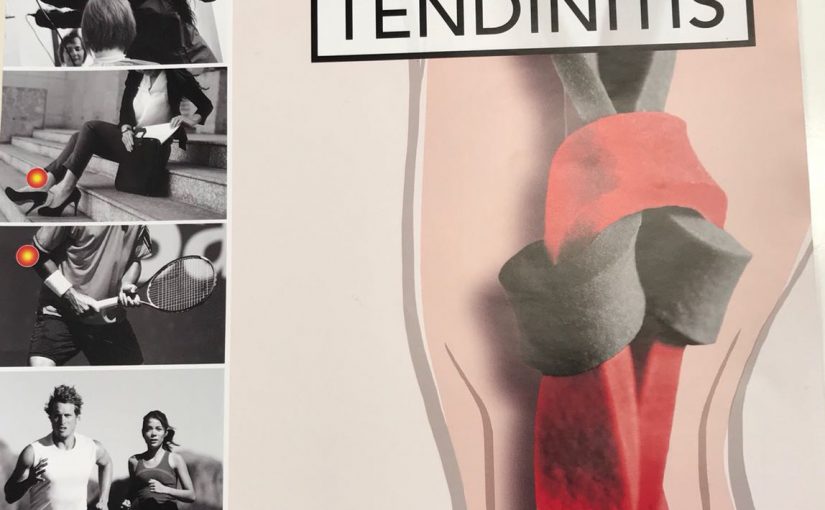 Tendinitis: Consejos para su tratamiento y prevención